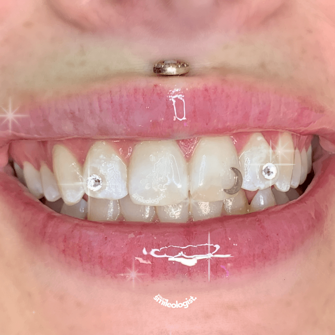 How Long Do They Last?