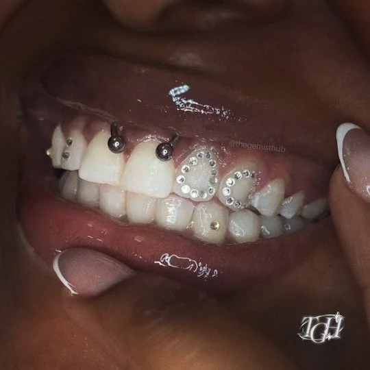 Custom grillz design outline