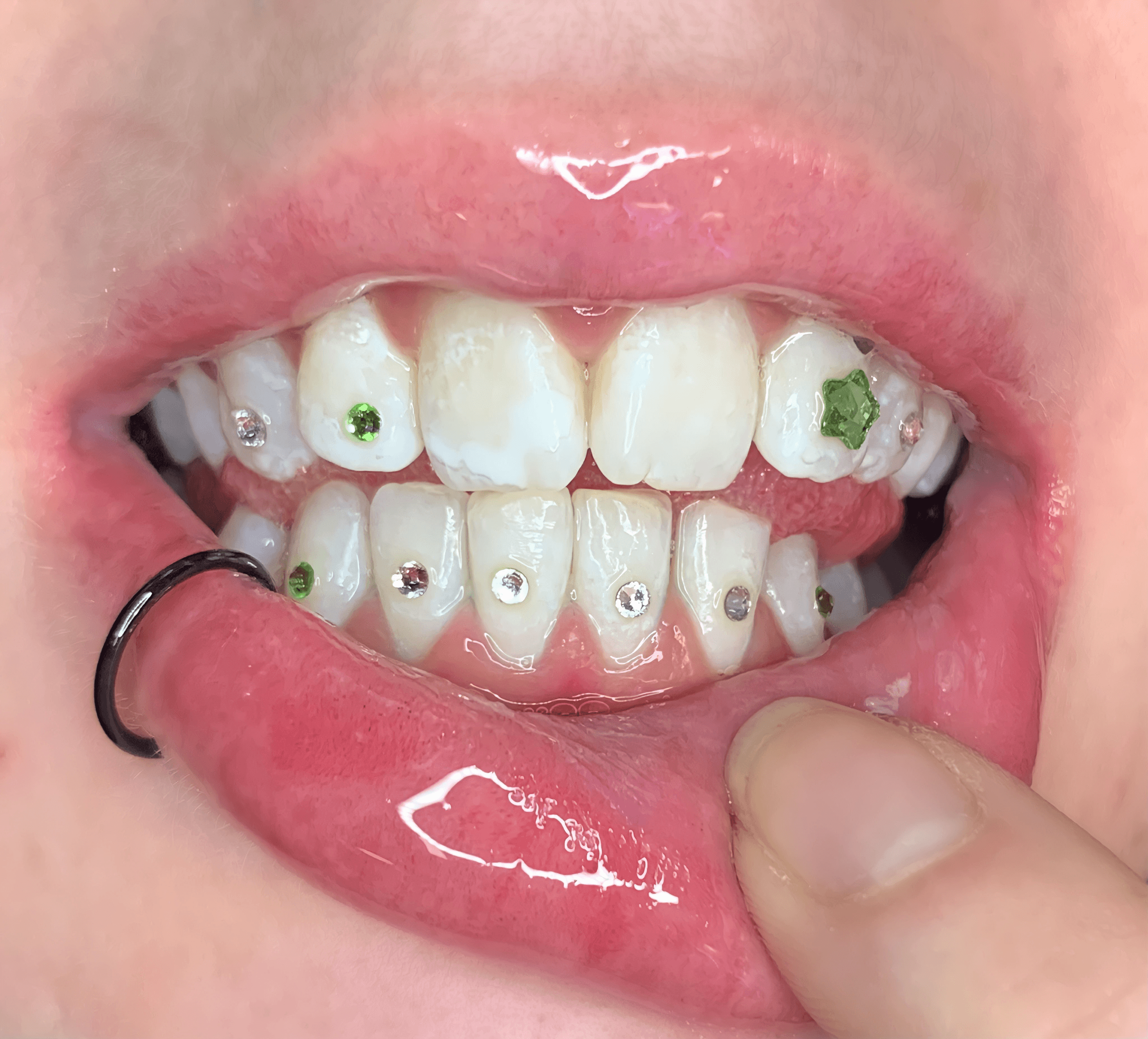 What Are Tooth Gems?