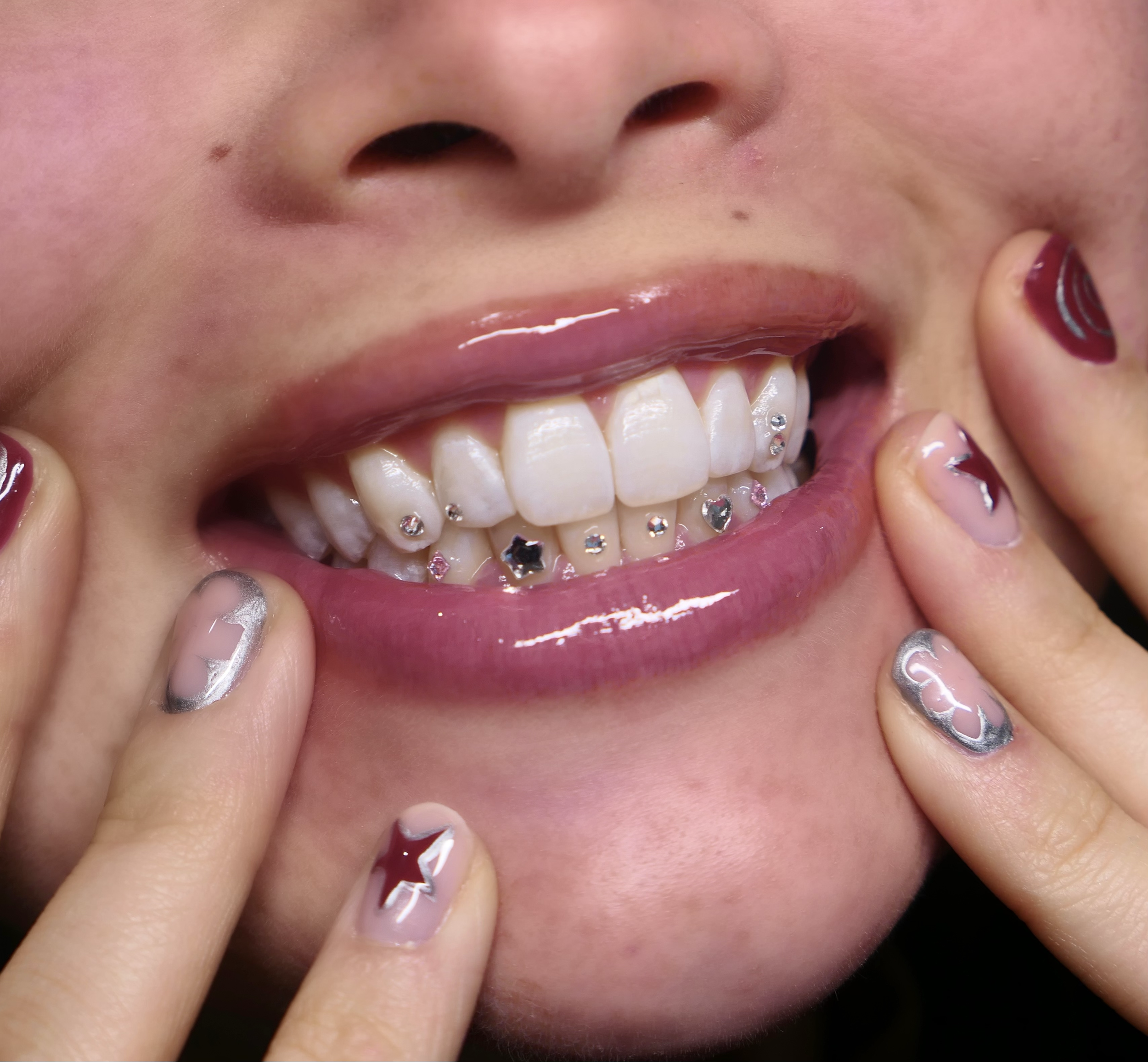 Tooth gem styling for special events