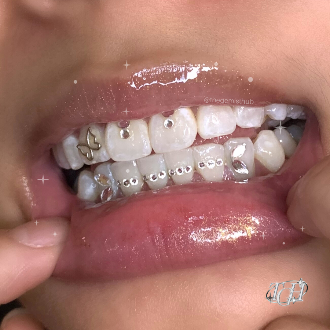 Trending tooth gem designs